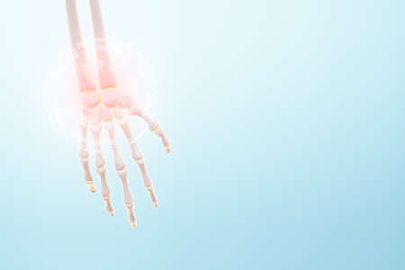 Medical poster image of the bones of the hand, arm bones. Arthritis, inflammation, fracture, cartilage,. Copy space, 3D illustration, 3D renderの写真素材