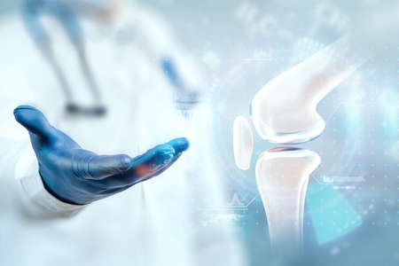 Medical poster image of the bones of the knee, the joint in the knee. Arthritis, inflammation, fracture, cartilage,. copyspace.の写真素材