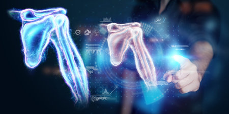 Medical poster, human body anatomy, shoulder joint x-ray, bones hologram. The doctor looks at the patient's x-ray hologram. surgery, modern medicine, technologyの写真素材