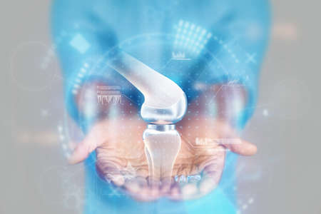 Medical concept, doctor's hands close-up. Ultrasound, x-ray of the knee joint, hologram. Medical care, anatomy, doctor's appointment, transplantation, cartilage replacement. mixed mediaの写真素材