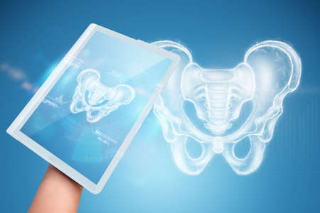 Tablet in doctor's hand close-up. X-ray of a patient's pelvis, hip joint skeleton, medical concept. Pelvic pain, fracture, joint problemsの写真素材