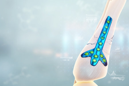 Medical procedure, osteosynthesis operation, surgical repositioning of leg bones. Fixation of a...