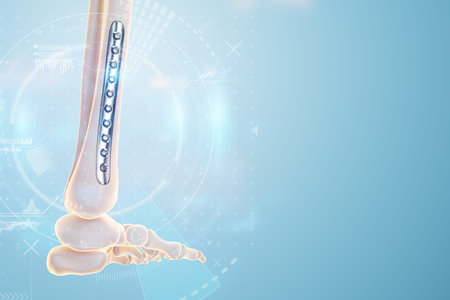 Medical procedure, osteosynthesis operation, surgical repositioning of leg bones. Fixation of a...
