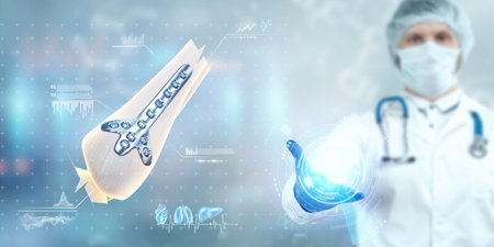 Medical procedure, osteosynthesis operation, surgical repositioning of leg bones. Fixation of a broken bone with a metal plate, technology, fixation of a fractureの写真素材