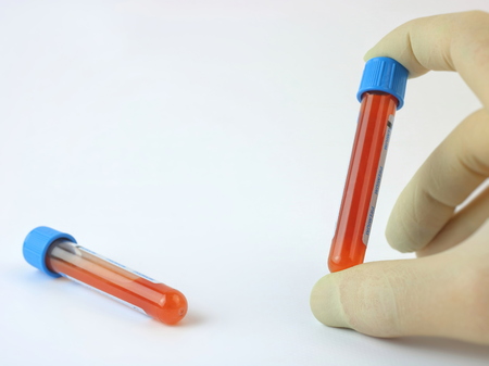 Hand holding test tube with blood plasma ready for testing isolated on white background.の写真素材