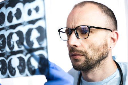 A man doctor in glasses holds a computed tomography in his hands and examining the picture. Pneumonia, bronchitis, coronavirus. Diagnosis of the disease in the early stages. Close-up.の写真素材