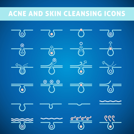icon acne, schematic view of a skin care, problem skin with acne in sectionのイラスト素材