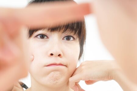 Young woman caring for skin problemsの写真素材