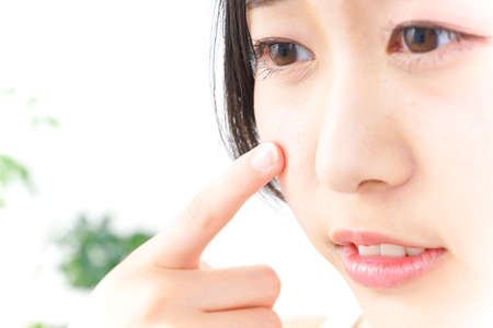 skin troubleの写真素材