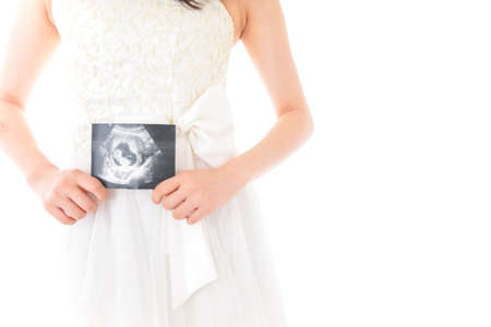 Pregnant woman holding ultrasound image of her baby on white backgroundの写真素材