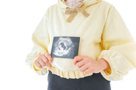 A pregnant woman holding an ultrasound image of her baby, isolated on white backgroundの写真素材
