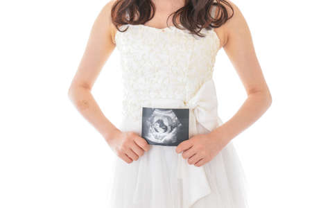 Pregnant woman holding ultrasound image of baby in her hands isolated on white backgroundの写真素材