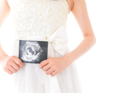 Pregnant woman holding ultrasound scan over white background, closeup