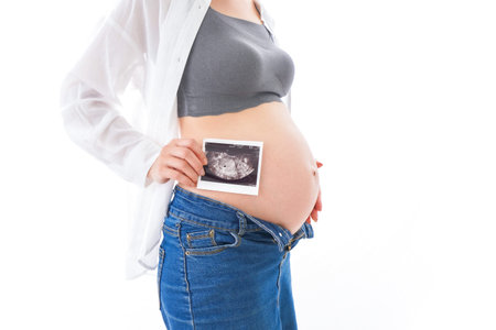 Pregnant woman holding ultrasound image of her belly on white background