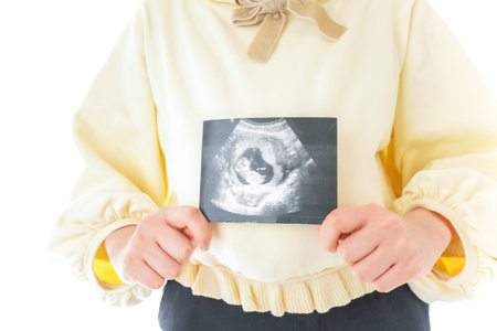Woman holding ultrasound image of baby on white background, closeup.