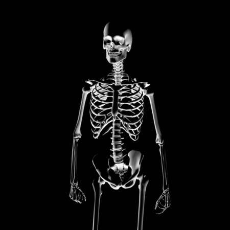 Illustration: skeleton to the x-rayの写真素材