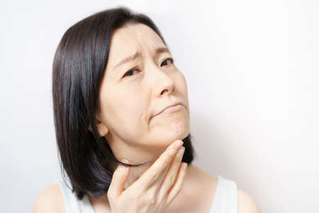 Middle-aged woman touching her face and suffering from skin problemsの写真素材
