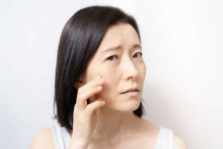 Middle-aged woman touching her face and suffering from skin problemsの写真素材