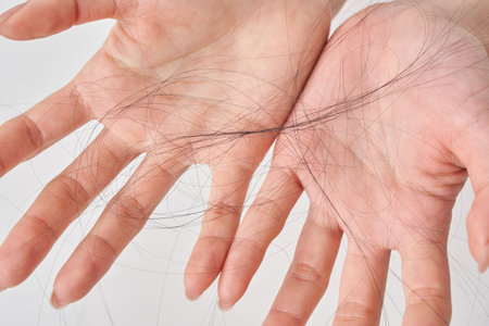 Hand of a woman with lost hair and white backgroundの写真素材