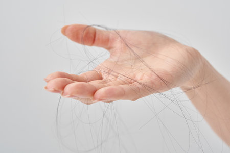 Hand of a woman with lost hair and white backgroundの写真素材
