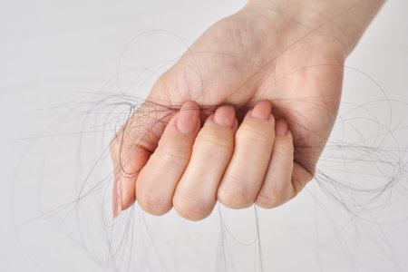 Hand of a woman with lost hair and white backgroundの写真素材