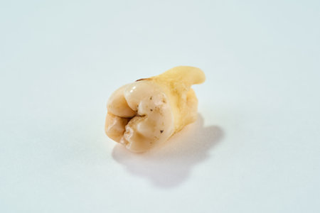 Extracted tooth in its original state and white background