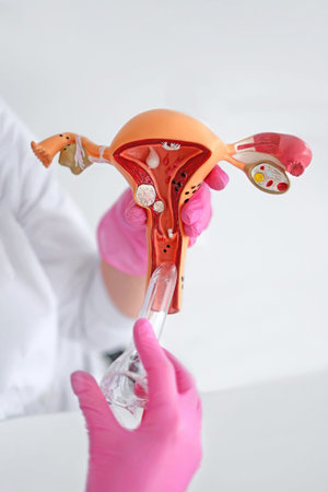 Close-up of gynecology anatomy model showing uterus, cervix and ovaries in doctor hands. Medical education, diagnosis and women healthcare concept on white background.の写真素材