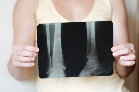 Woman holding an x-ray image の写真素材
