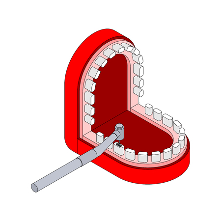 Dental Drill in mouth. Dentist treatment. Dentistry Vector illustrationのイラスト素材