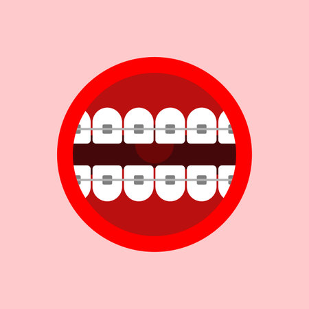 Mouth with braces isolated. correction of occlusion and crooked teethのイラスト素材