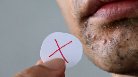 A Japanese man with rough skin