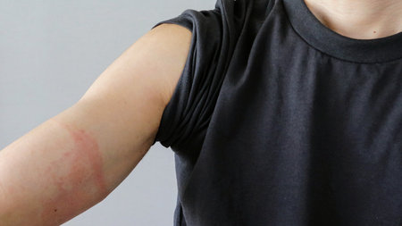 Rough skin on the arm of a Japanese man