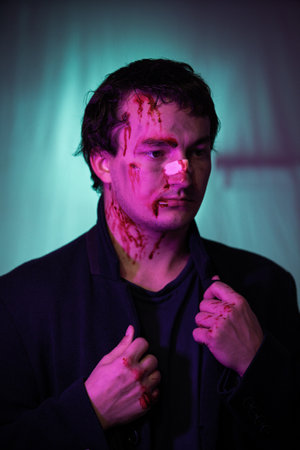 Male intellectual coat portrait beating abrasions blood face victim of violence pensive look....