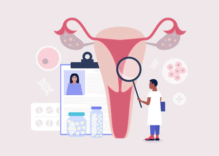 Gynecology and female health concept. Young man checks ovary and womb. Colorful flat vector illustrationのイラスト素材