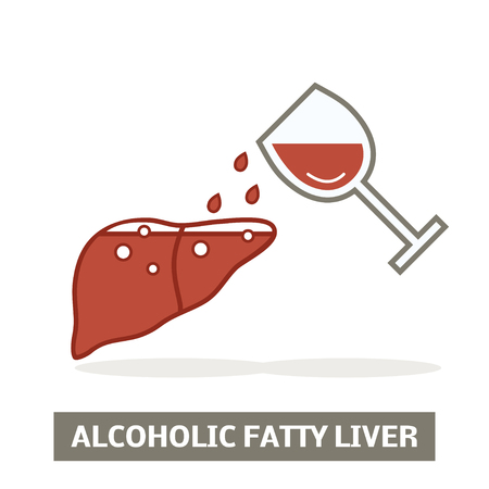 Alcoholic fatty liver conceptのイラスト素材