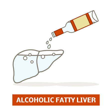 Alcoholic fatty liver concept. Silhouette of a liver is being filled with a vodkaのイラスト素材
