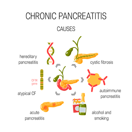 Causes of chronic pancreatitis. Medical vector concept.のイラスト素材