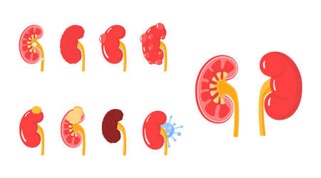 Kidney diseases. Anatomical icons for medical designs. Vector illustration isolated on a white background in cartoon style.のイラスト素材