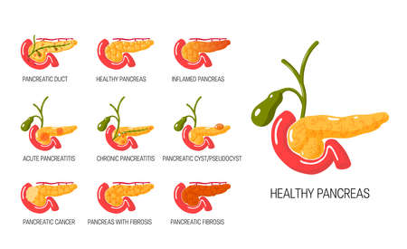 Pancreas diseases concept. Set of anatomical icons for medical designs. Vector illustration isolated on a white background in cartoon style.のイラスト素材
