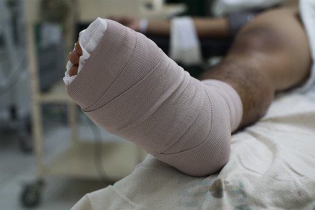 Close up view of a diabetic foot with bandage after surgery.