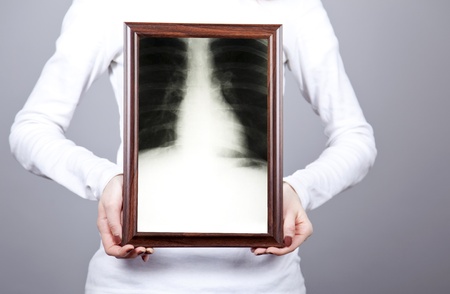 Girl keep frame with x-ray inside. Studio shot.の写真素材