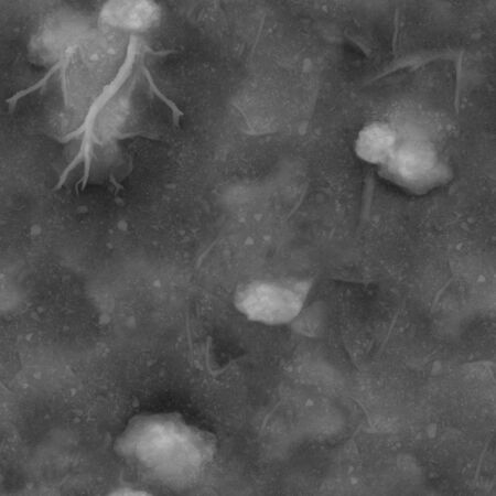 Bacteria and germs causing various diseases of a man under a strong magnification of the microscope