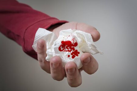 hand holding a paper handkerchief with blood