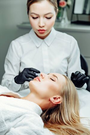 Non-surgical cosmetology. Filler injections. Correction of the shape of the upper lip.の写真素材