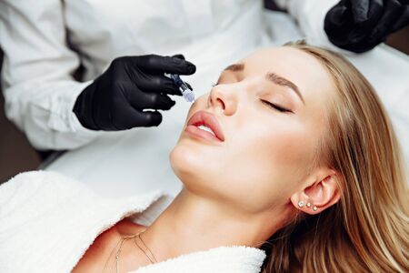 Non-surgical cosmetology. Filler injections. Correction of the shape of the upper lip.の写真素材