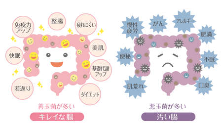 In Japanese, it is described as "good sleep", "anti-aging", "diet", "beautiful skin", "good bacteria", "constipation", "fatigue", "allergy", "insomnia", "obesity", "rough skin", and "bad bacteria".のイラスト素材