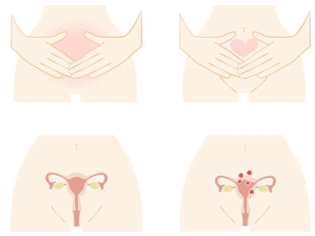 Illustration set of female lower abdomen and uterusのイラスト素材