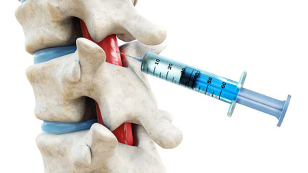 Syringe in the spinal cord isolated on a white background. Backbone or spinal column treatment with epidural injection 3D rendering illustration. Medical and healthcare, anatomy, medicine concept.の写真素材