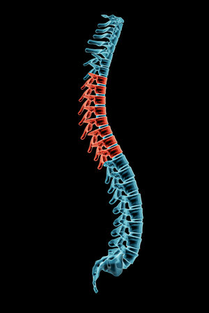 X-ray spinal column with kyphosis posture and pathological vertebrae highlighted in red. Human curvature of the spine disorder 3D rendering illustration. Medical and healthcare, medicine and anatomy concept.の写真素材
