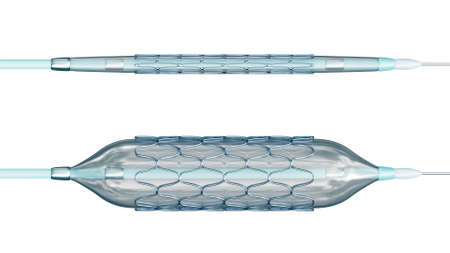 Deployed and collapsed stent ready for angioplasty isolated on white background 3D rendering illustration. Medical, surgery, cardiology, medicine, science, technology, healthcare concept.の写真素材